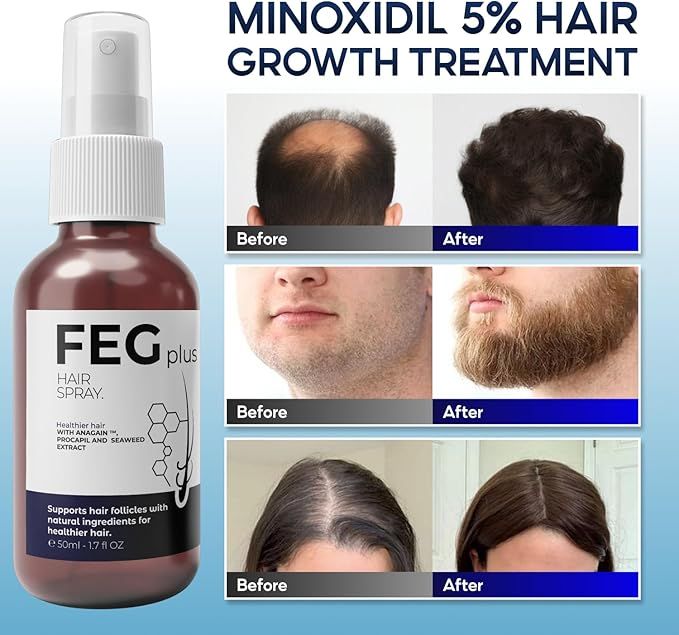 FEG™ PLUS | The Most Popular Hair Growth Spray